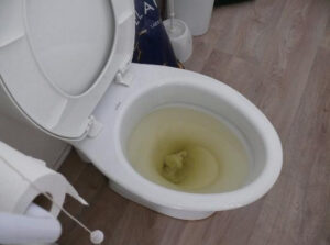 Bồn cầu thoát nước chậm do bể phốt đầy